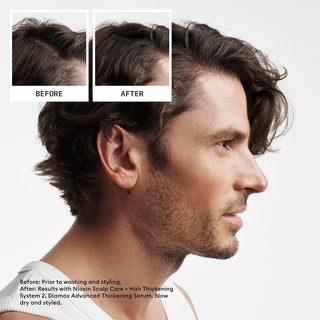 NIOXINSystem2TrialKitBefore_After