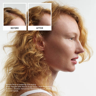 NIOXONSystem2TrialKitBefore_After
