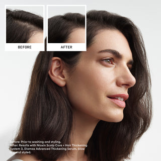 NIOXIN System 3 Scalp & Hair Trial Kit